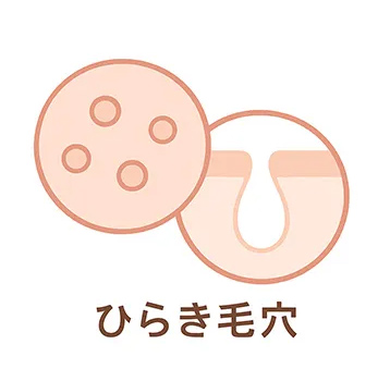 ひらき毛穴