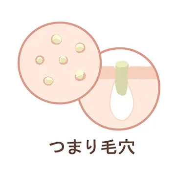 つまり毛穴
