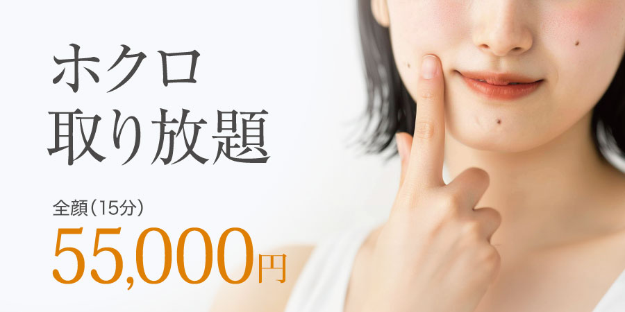 ホクロ取り放題