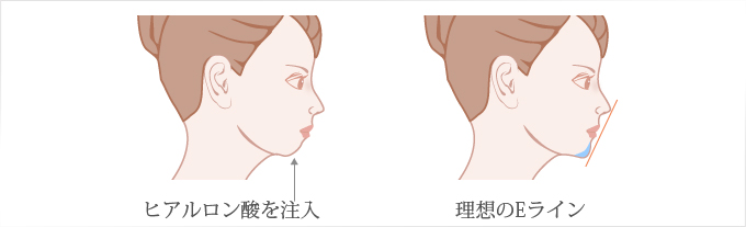 理想のEライン