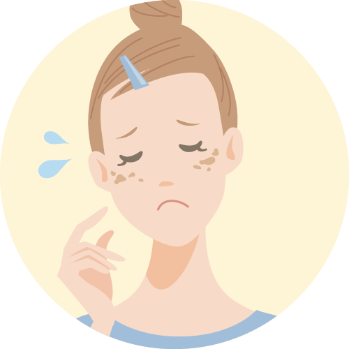 シミ・そばかす