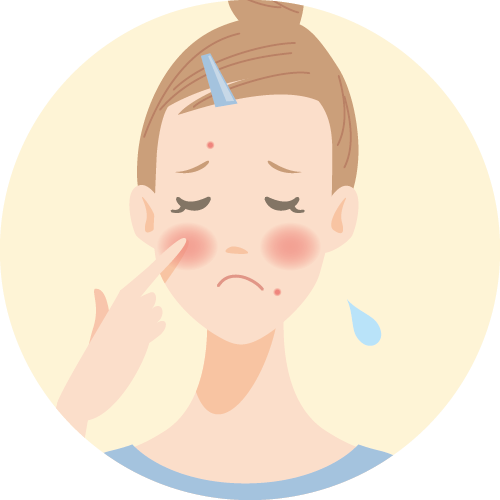 赤ら顔・ニキビ跡の赤み