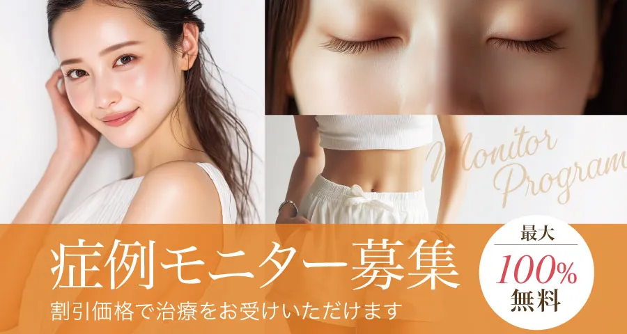 症例モニター募集