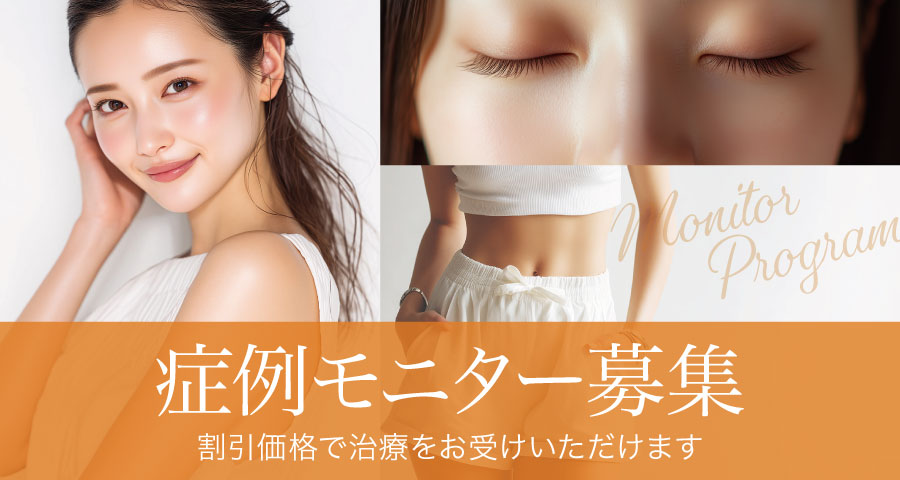 症例モニター募集