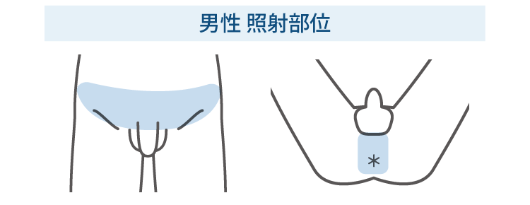 男性照射部位
