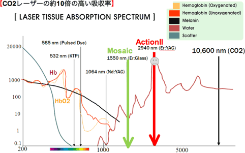 Co2レーザーの約10倍の高い吸収率