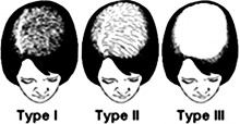 type1 type2 type3