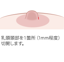 当院だからできる「簡易治療方法」