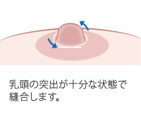 当院だからできる「簡易治療方法」