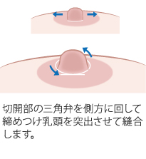 軽度の場合