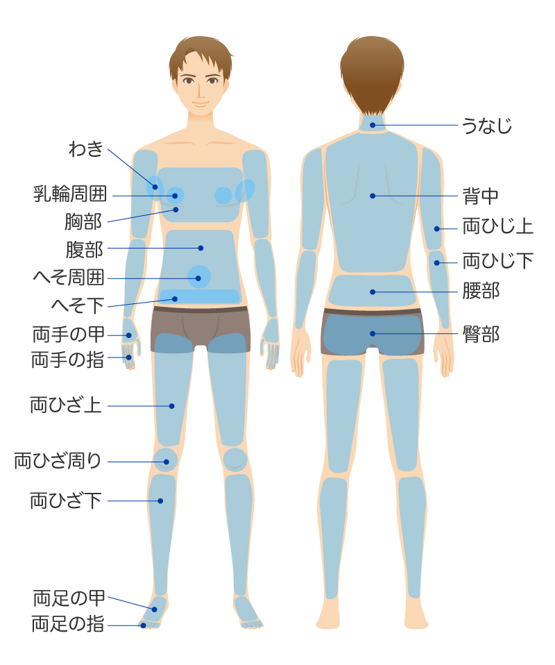 男性脱毛の範囲