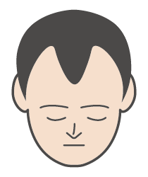 M字ハゲ