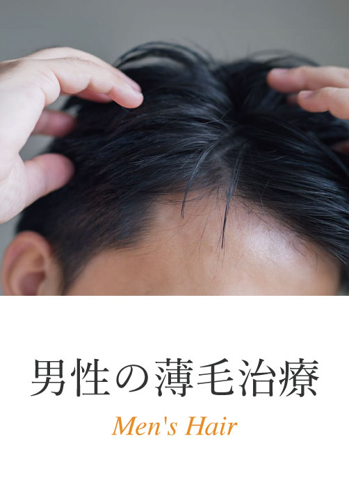 男性のの薄毛治療