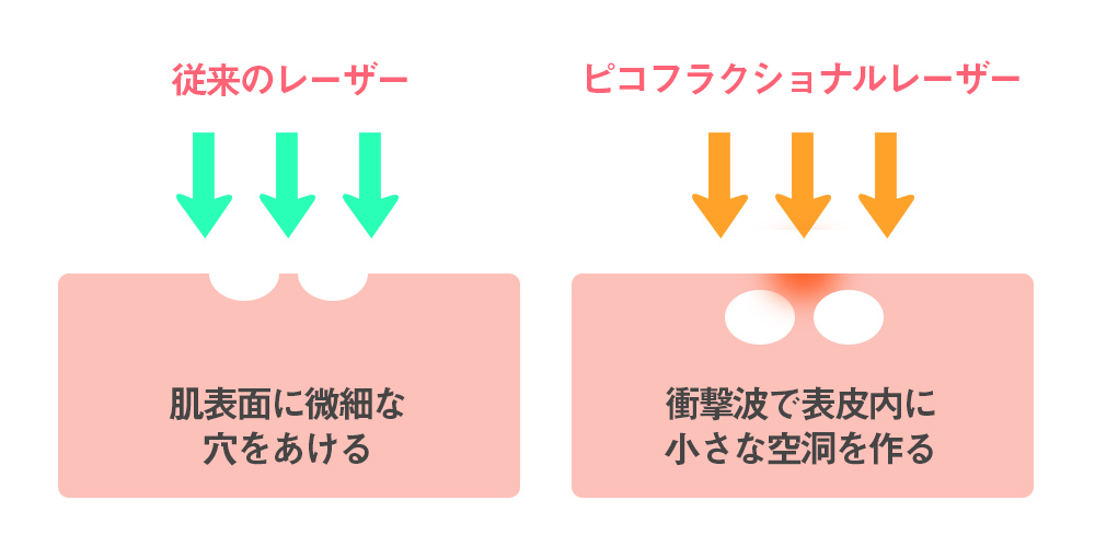 組織の熱影響の比較