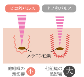 組織の熱影響の比較