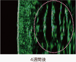 施術後