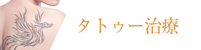 タトゥー除去