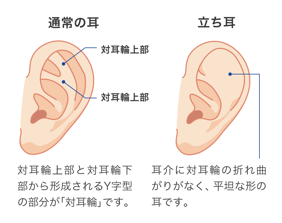 通常の耳とたち耳の違い