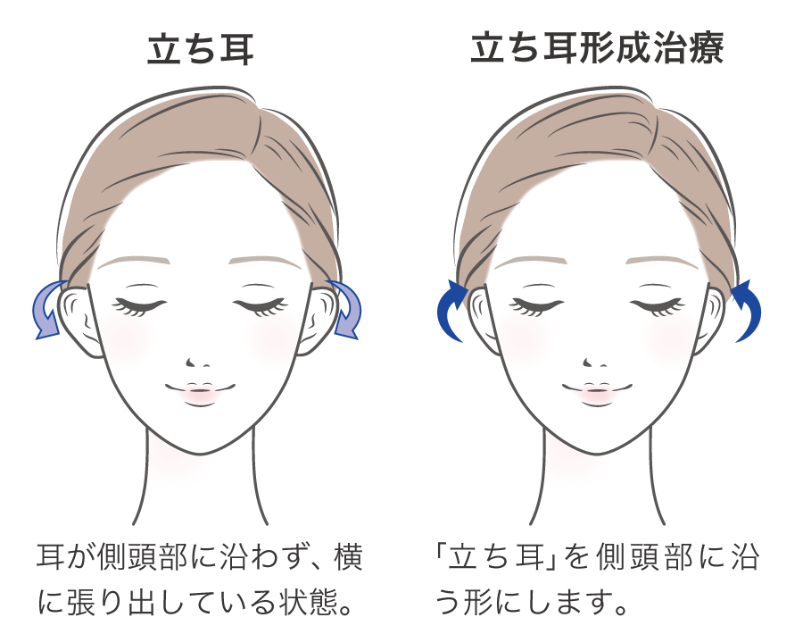 立ち耳の原因