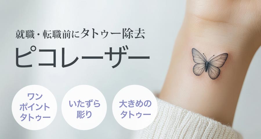 就職・転職前にタトゥー除去ピコレーザー