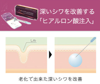 ビスタシェイプとは